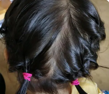 西瓜头发型女宝宝教程图片