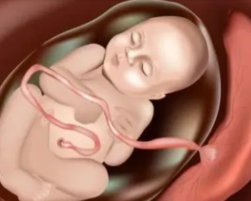 胎儿38周在肚子里的样子3