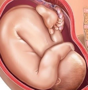 子宫的样子怀孕图片