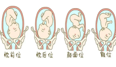 判断胎儿是否头位比较准确的方法了,通过超声影像观察胎儿的胎位情况