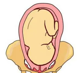 10个月胎位图2
