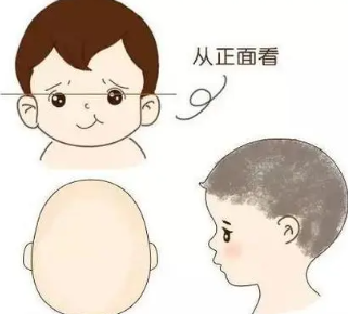 婴幼儿正常头型1
