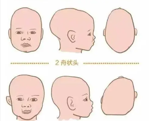 新生儿头型图片 标准图片